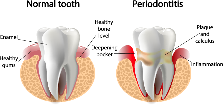 Periodontics